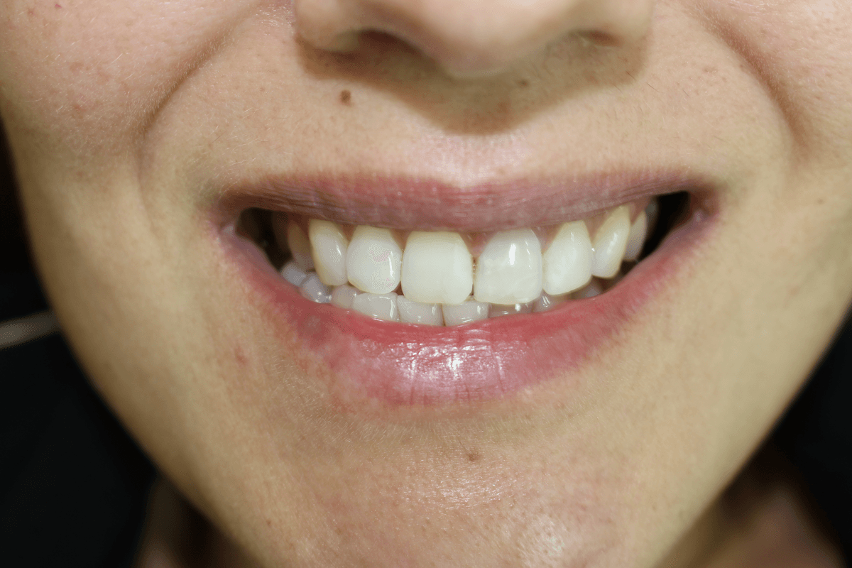 Responsible cosmetic dentistry